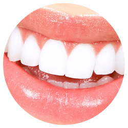 Beaming White Teeth Whitening