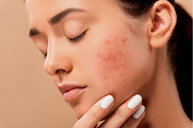 How to avoid skin problems during the pandemic