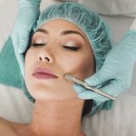 How Microneedling Can Transform Your Skin