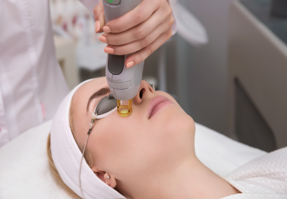 Laser skin treatment for acne and acne scars in Rock Hill, SC, near Charlotte, NC.