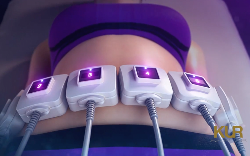 truSculpt ID treatment