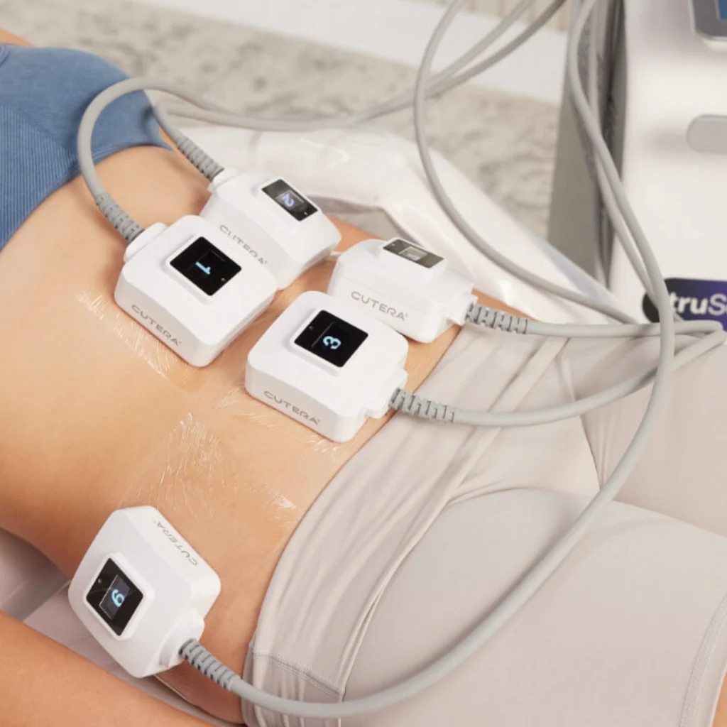 truSculpt ID treatment