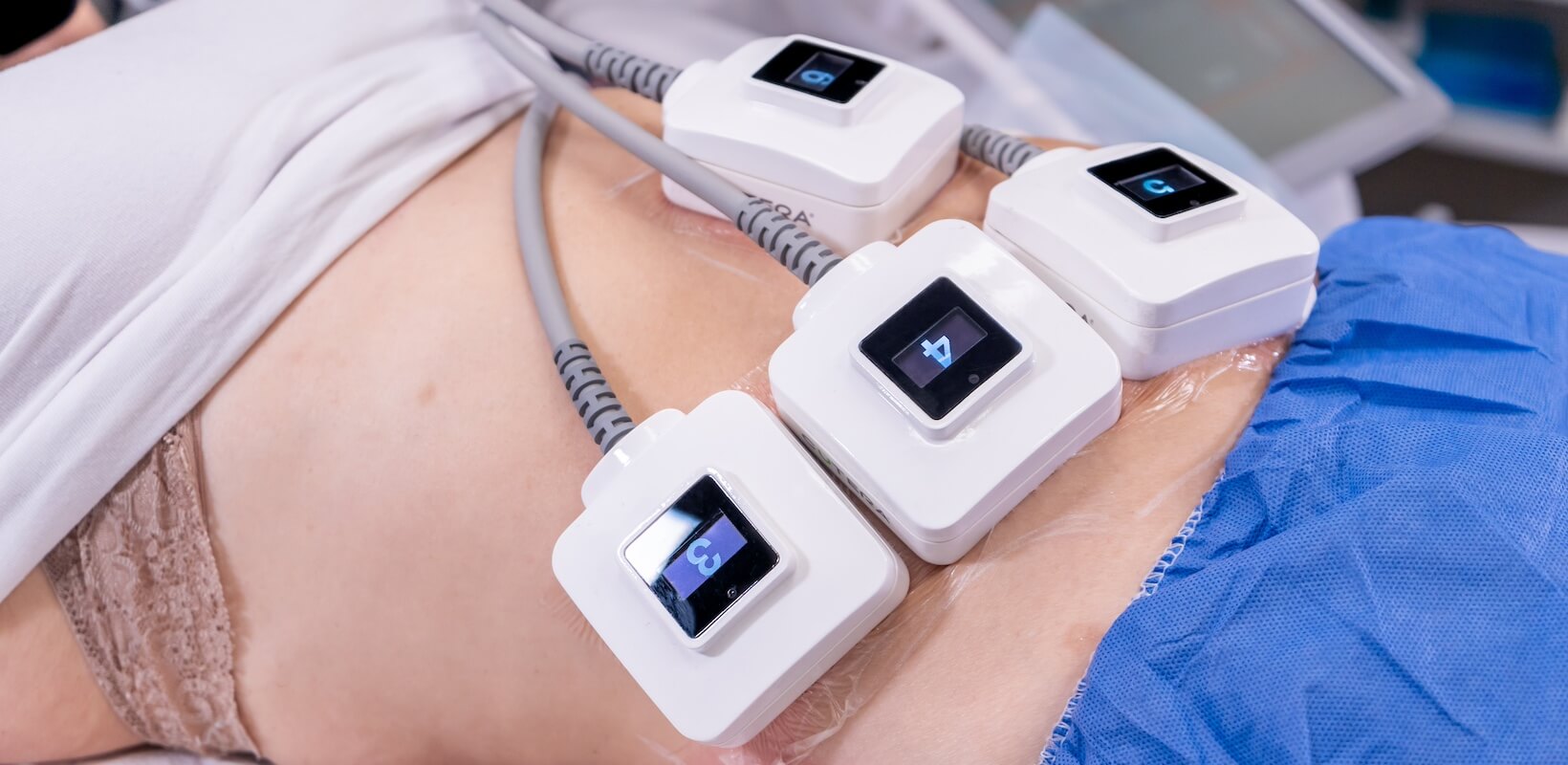 truSculpt ID treatment